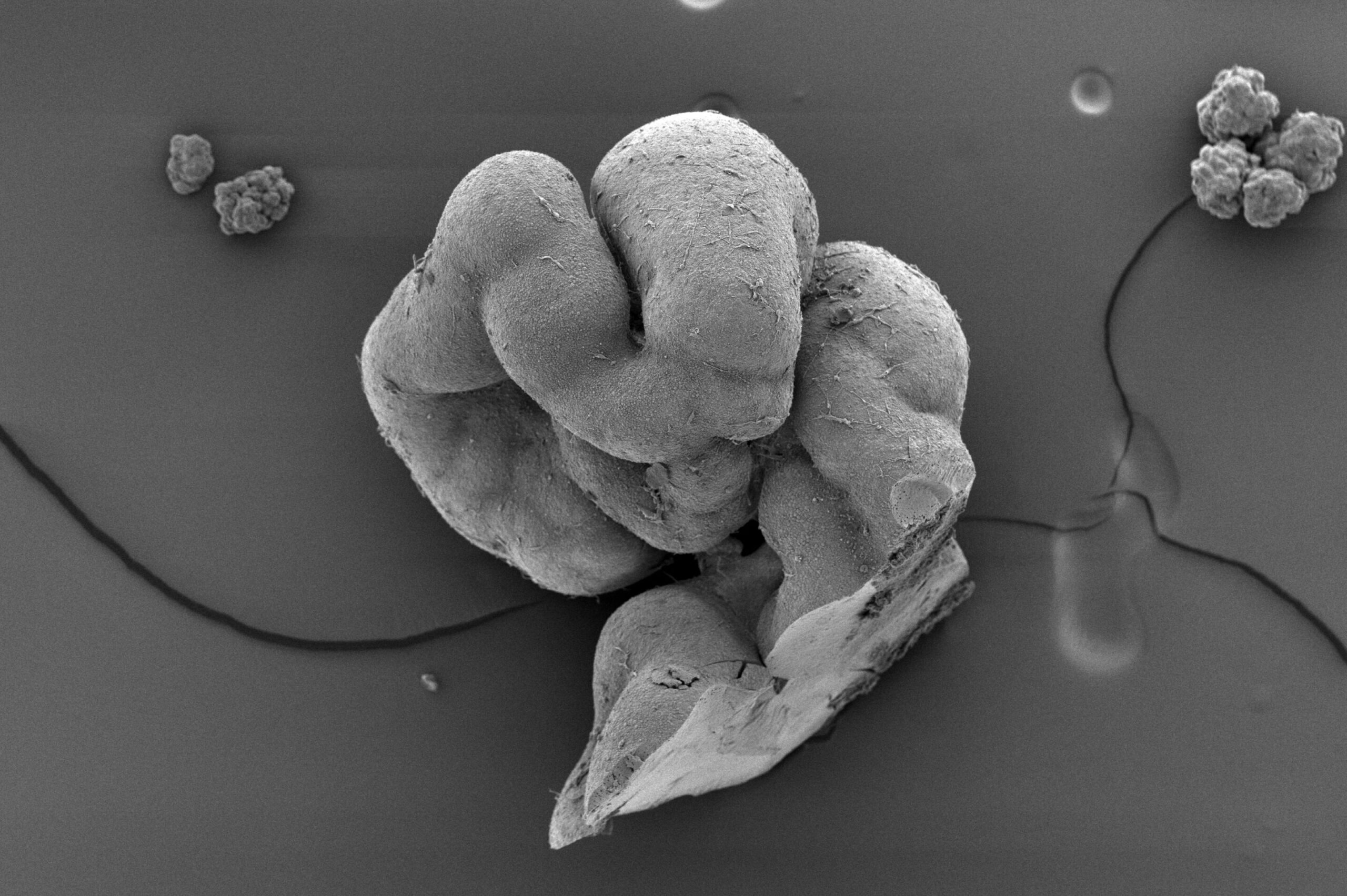 Electron scanning microscopy image showing a very detailed look at pieces of trunk organoids. Credit: Tiago Rito, Marie-Charlotte Domart